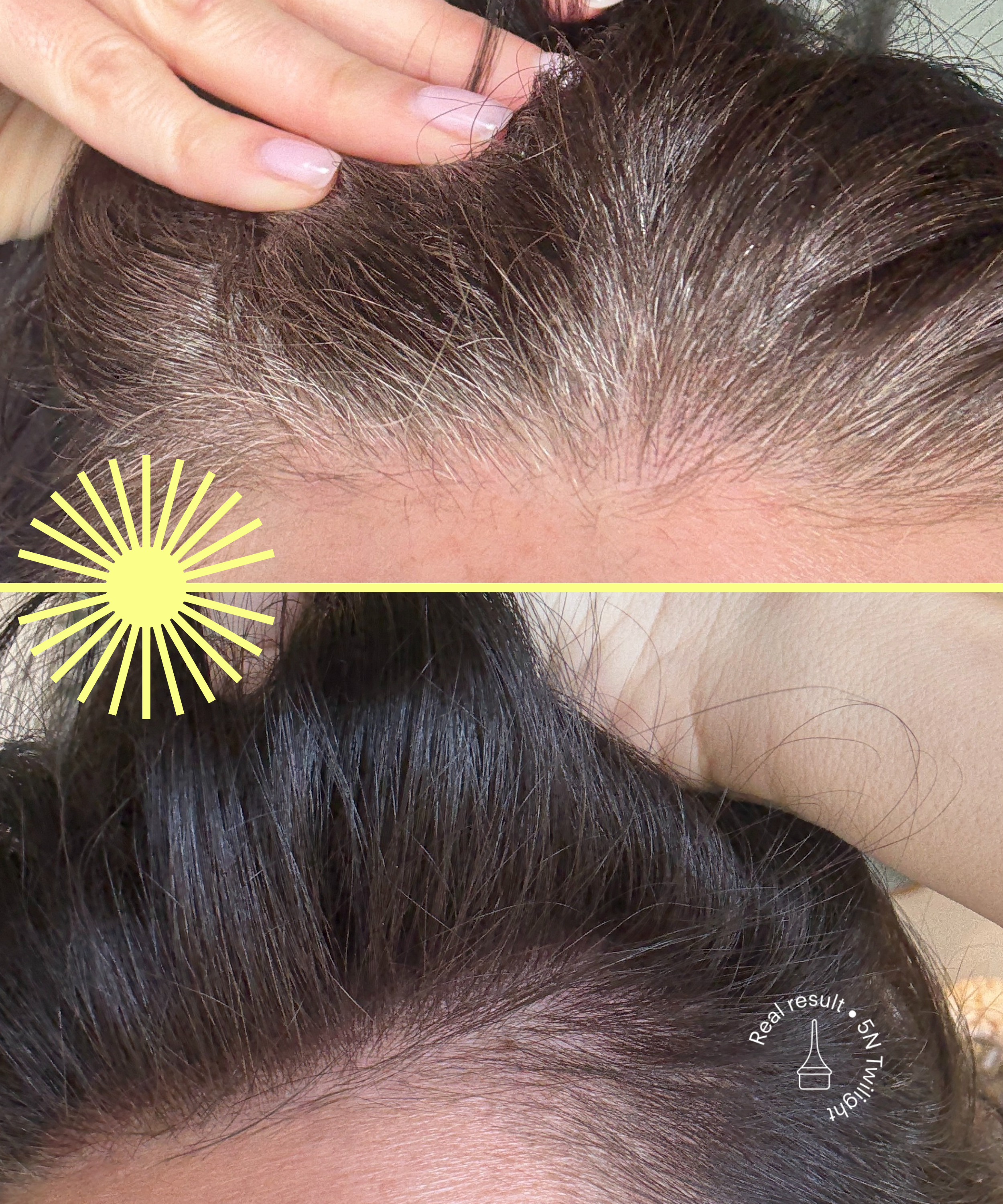 Ultimate Root Retouch Kit